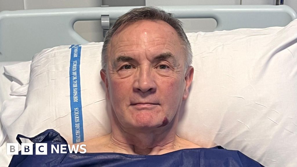 Atrial fibrillation: First of its kind therapy for ‘debilitating’ heart condition