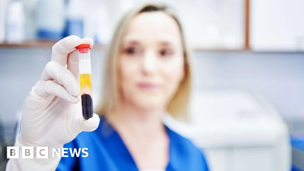 Blood test for 50 cancers fails key goal in NHS trial