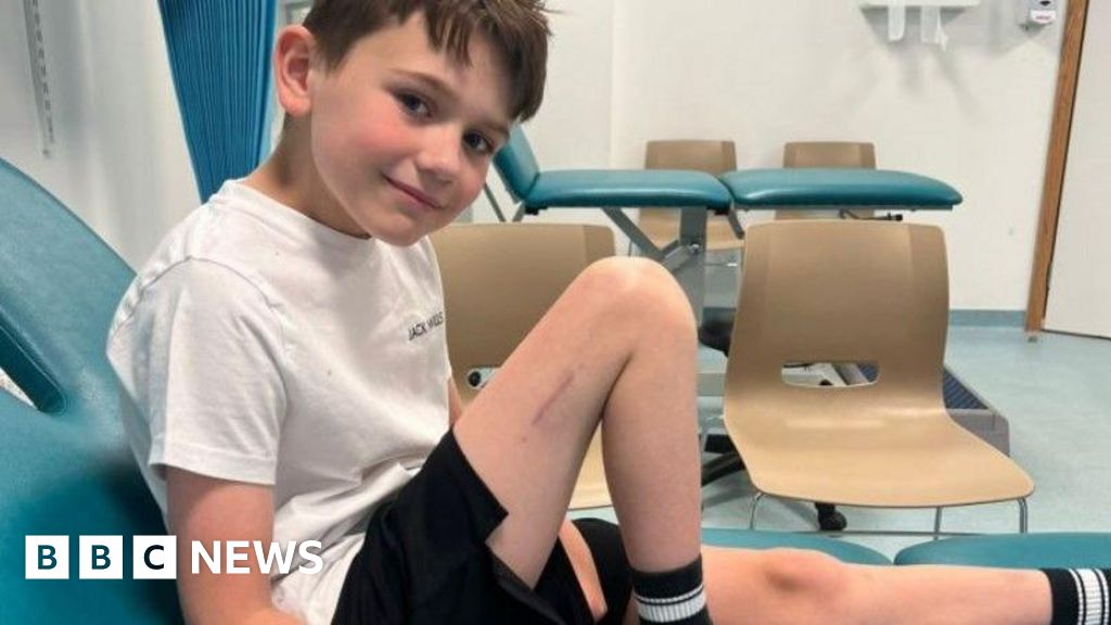 Boy, 9, in UK-first surgery to make him taller
