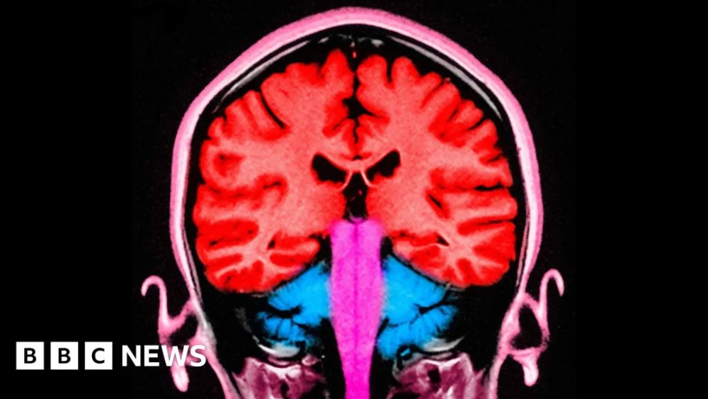 Brain stimulating test makes people ‘less selfish’