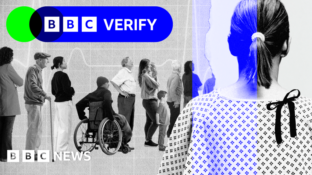 NHS tracker: are hospital surgery wait times improving near you?