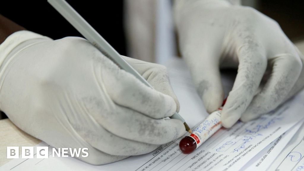 Zimbabwe rejects US health deal over sensitive data concerns.