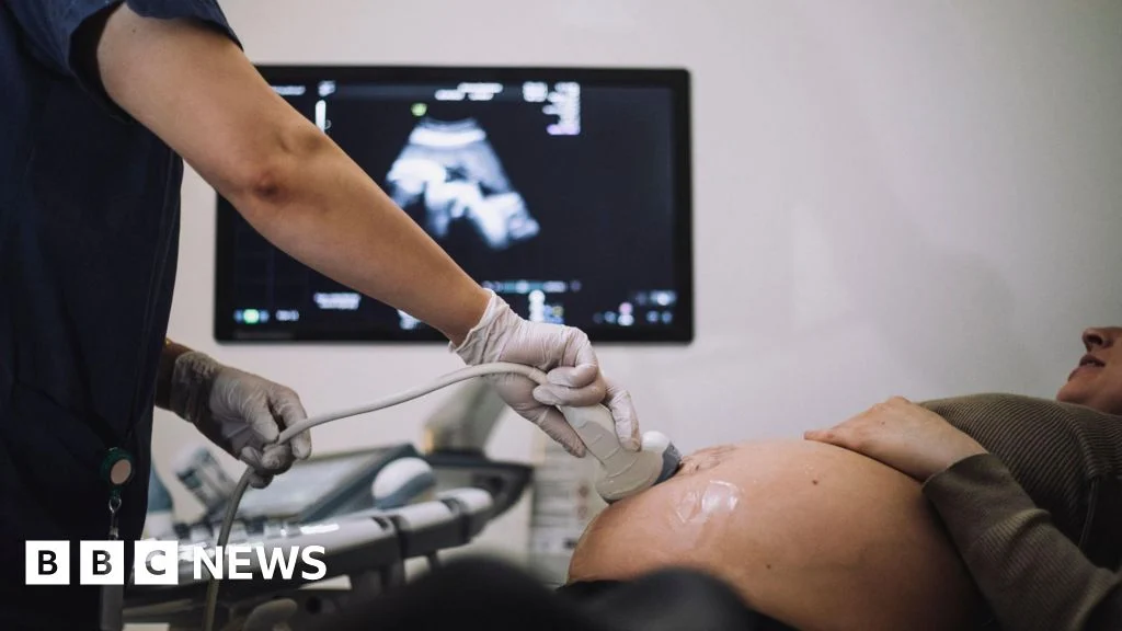 Better NHS care at Oxford hospital might have saved 58 babies, BBC finds