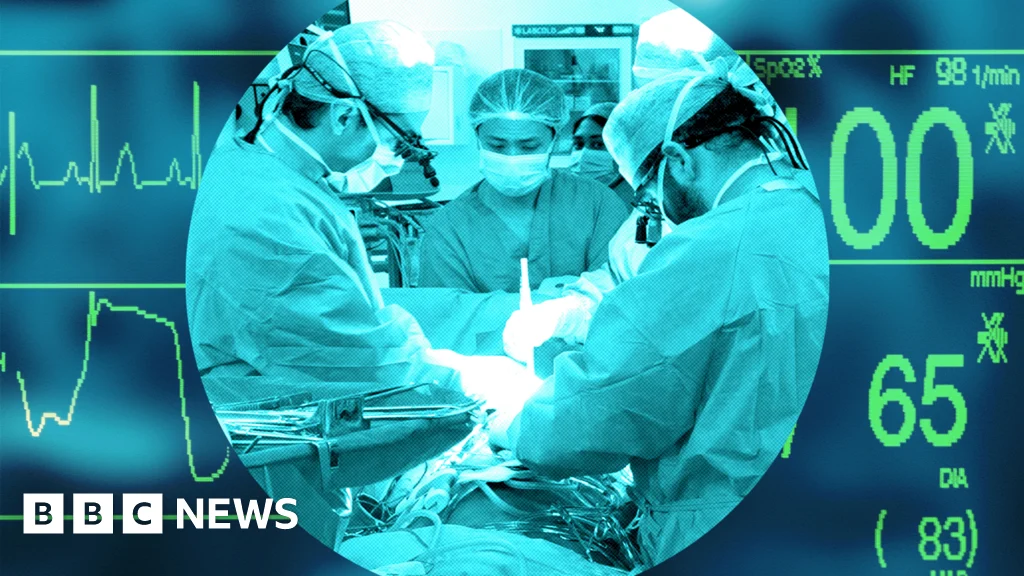 UK transplant system, once world-leading, now lags behind