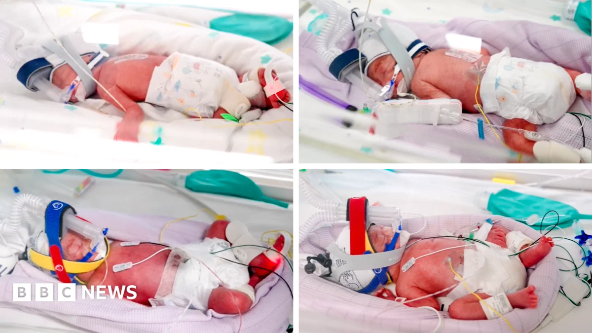Rare identical quadruplets born in Australia