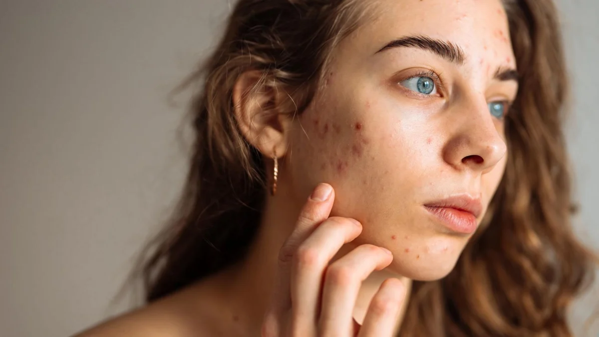 The simple skincare routine for teens that actually works – and five expert tips